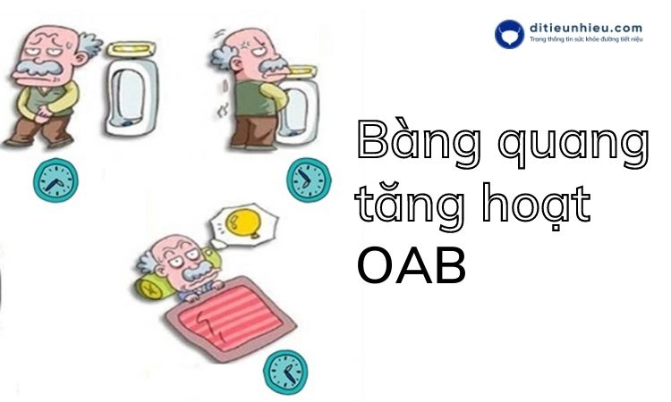 Chuyên gia nói gì về Bàng quang tăng hoạt OAB