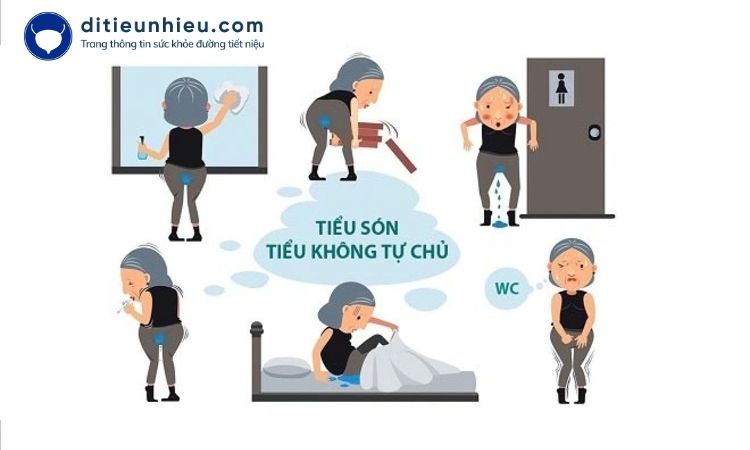 Tiểu són là gì? Nguyên nhân, triệu chứng và cách điều trị