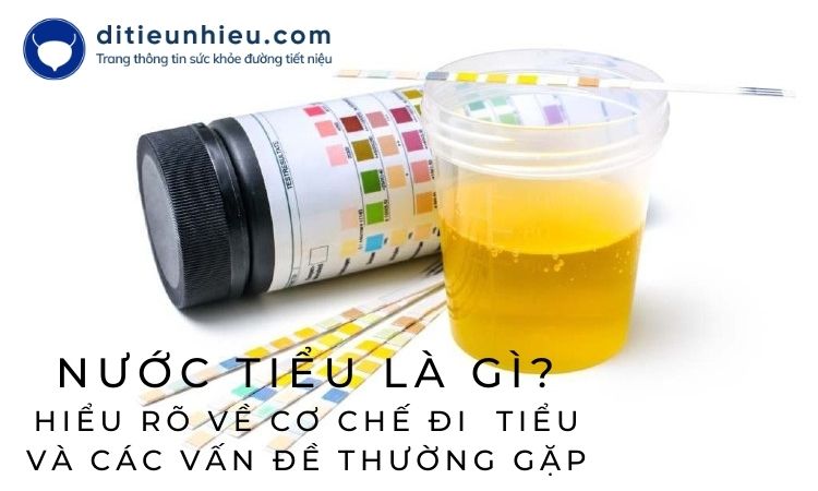 Nước tiểu là gì hiểu rõ về cơ chế đi tiểu và các vấn đề thường gặp?