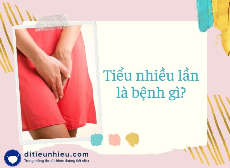 Tiểu nhiều lần là gì? Triệu chứng và cách khắc phục hiệu quả nhất